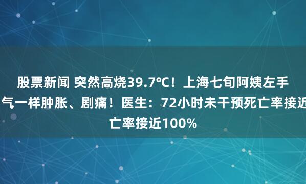 股票新闻 突然高烧39.7℃！上海七旬阿姨左手像充了气一样肿胀、剧痛！医生：72小时未干预死亡率接近100%